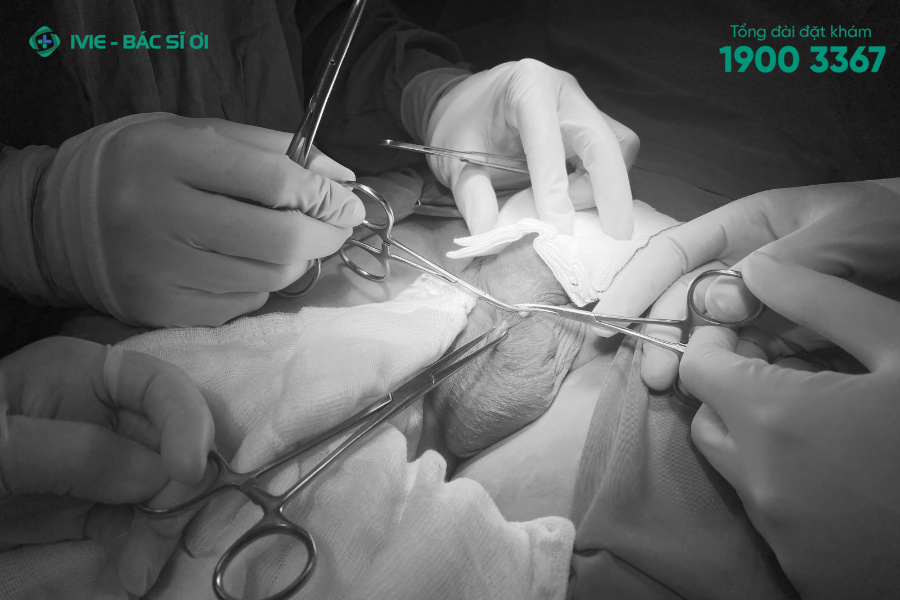 Thủ thuật thuật thắt ống dẫn tinh khá nhanh chóng và đơn giản