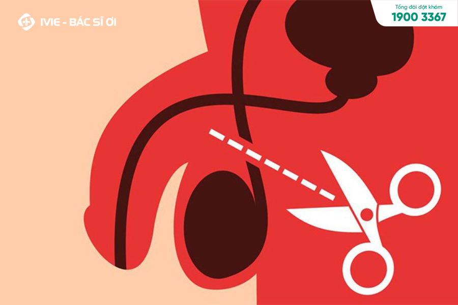 Thắt ống dẫn tinh giúp ngừa thai hiệu quả