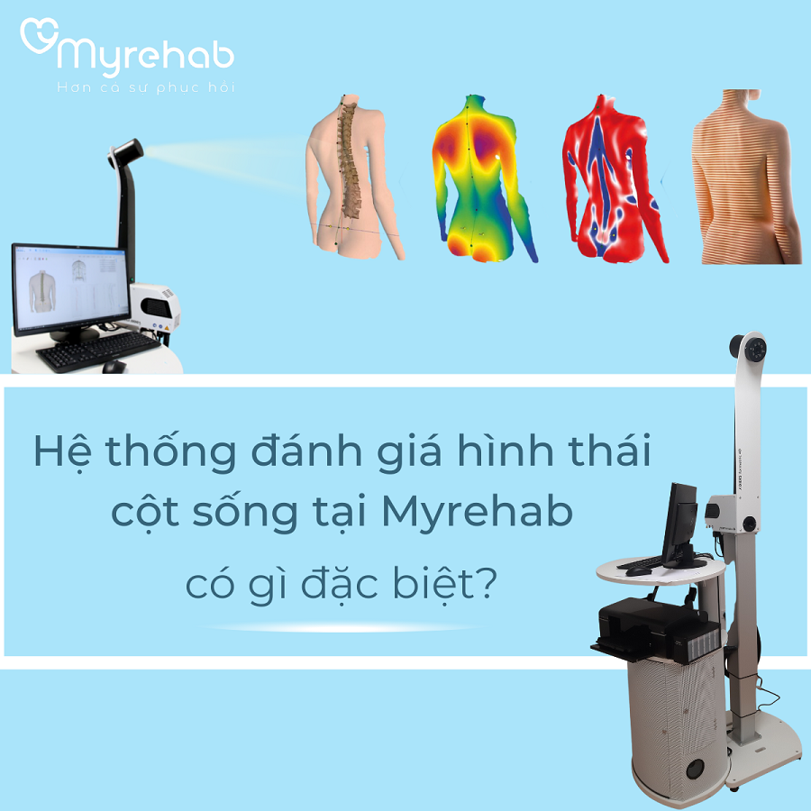 Trung tâm phục hồi chức năng Myrehab có nhiều thiết bị tập luyện hiện đại, tiên tiến