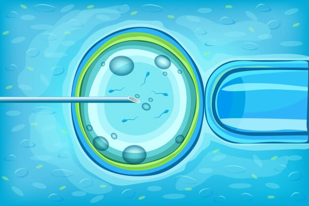 Kĩ thuật thụ tinh trong ống nghiệm (IVF)