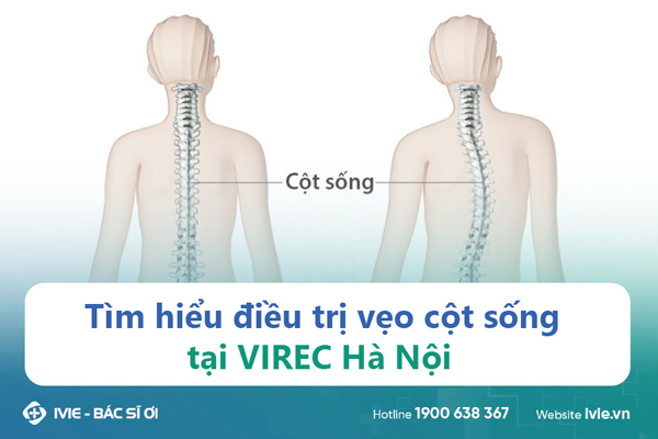 Tìm hiểu điều trị vẹo cột sống tại VIREC Hà Nội