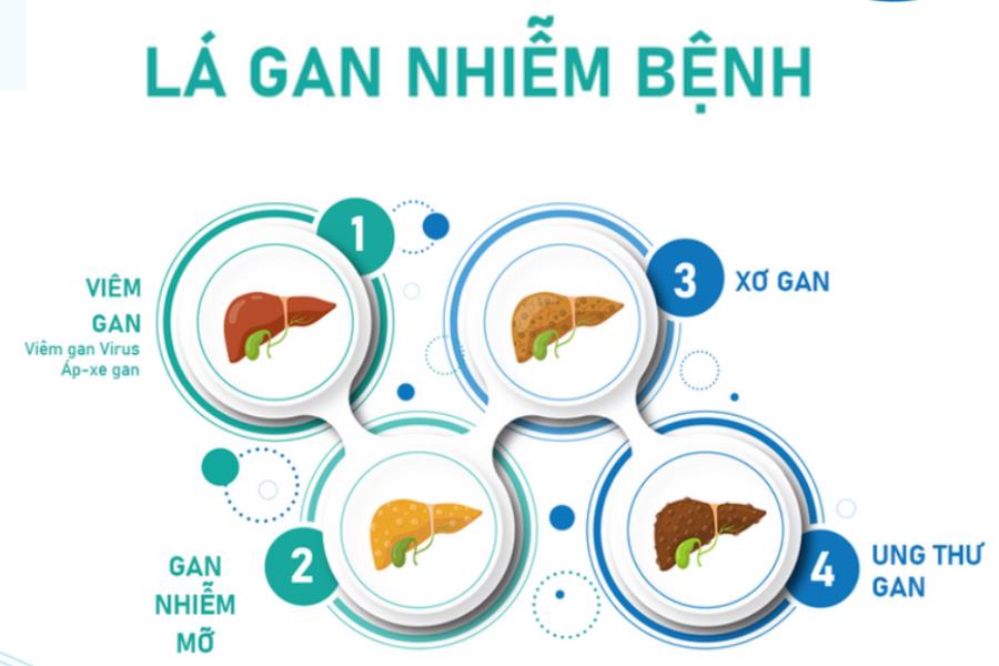 Gói xét nghiệm gan chuyên sâu biết được gan của bạn có nhiễm bệnh không