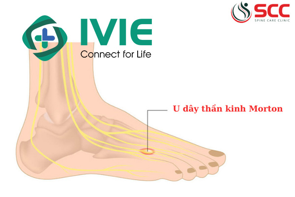 Tìm hiểu về Phòng khám SCC khám gì?