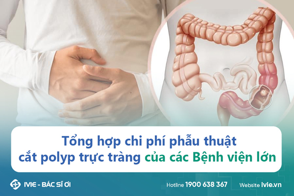 Tổng hợp chi phí phẫu thuật cắt polyp trực tràng của các...