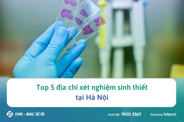Top 5 địa chỉ xét nghiệm sinh thiết tại Hà Nội