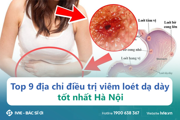 Top 9 địa chỉ điều trị viêm loét dạ dày tốt nhất Hà Nội