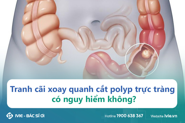 Tranh cãi xoay quanh cắt polyp trực tràng có nguy hiểm...