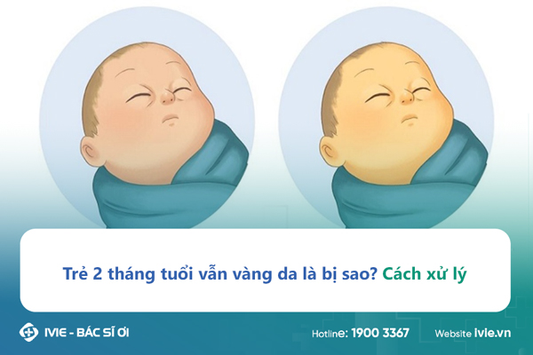 Trẻ 2 tháng tuổi vẫn vàng da là bị sao? Cách xử lý