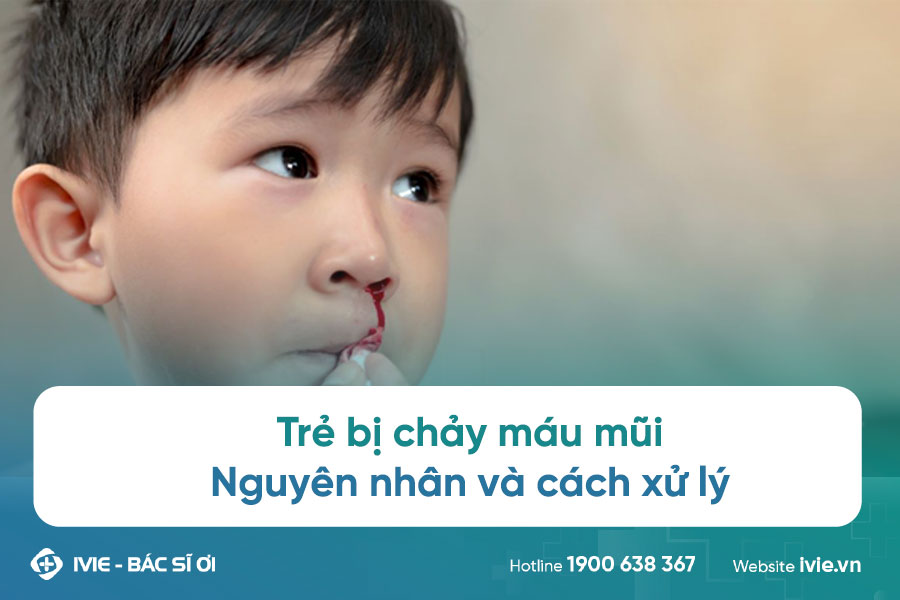 Trẻ bị chảy máu mũi: Nguyên nhân và cách xử lý