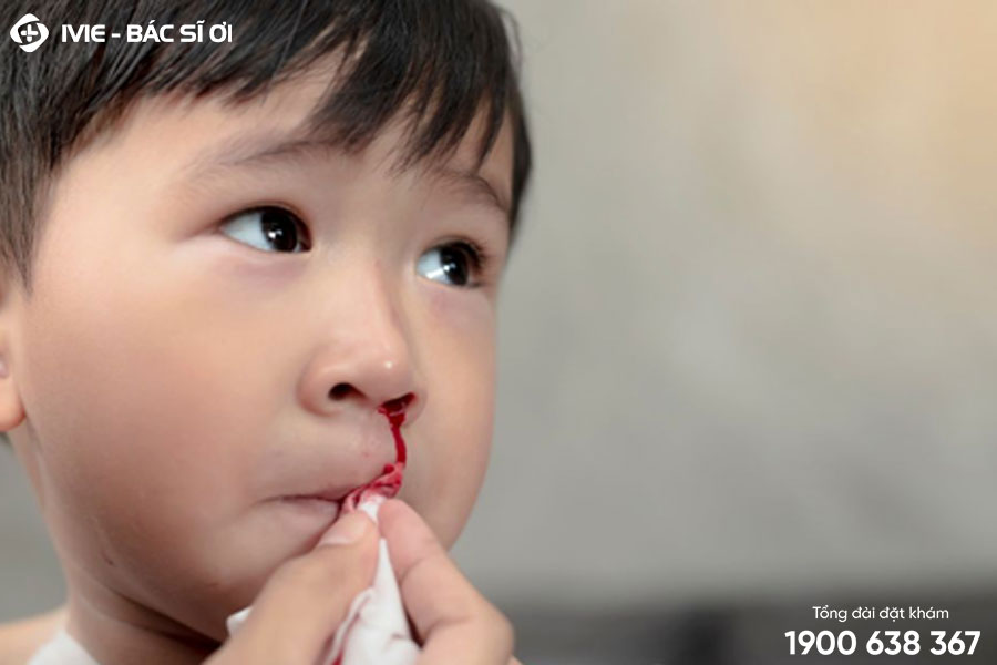 Trẻ bị chảy máu mũi thường hay gặp, nguyên nhân do đâu?