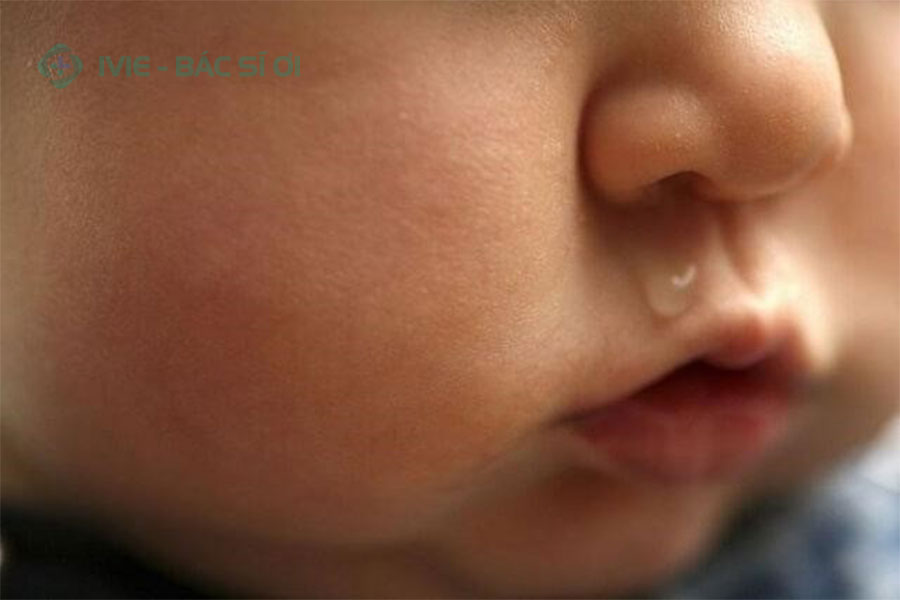 Trẻ bị sổ mũi kéo dài gây ảnh hưởng đến sức khỏe của trẻ