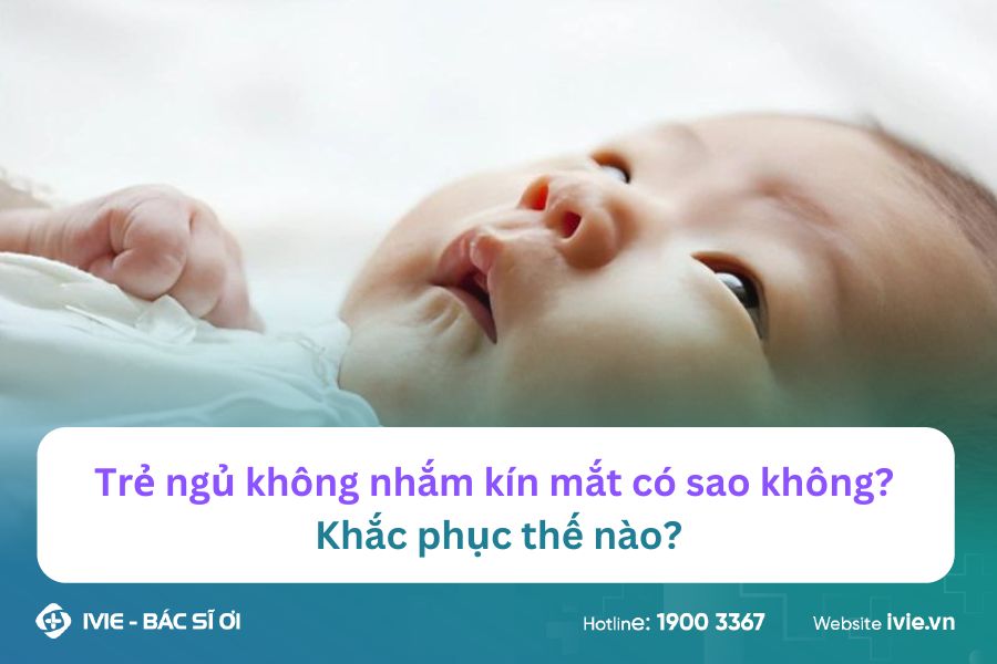 Trẻ ngủ không nhắm kín mắt có sao không? Khắc phục thế nào?