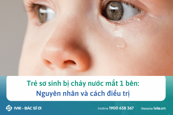 Trẻ sơ sinh bị chảy nước mắt 1 bên: Nguyên nhân và cách...