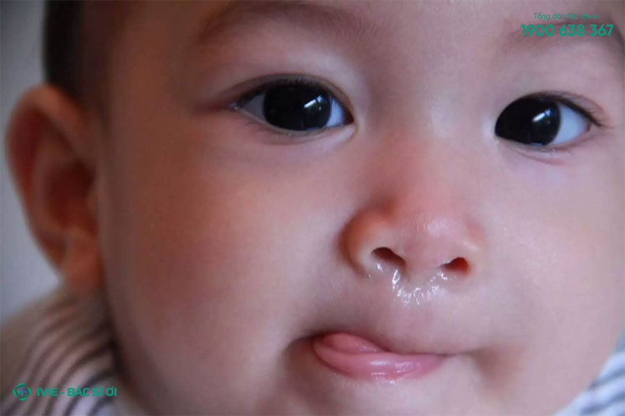 Trẻ sơ sinh bị chảy nước mũi thường do khoang mũi chứa một lượng lớn chất dịch nhầy