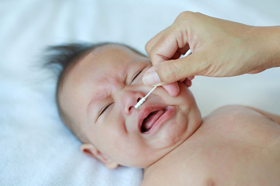 Trẻ sơ sinh bị nghẹt mũi là tình trạng gì?
