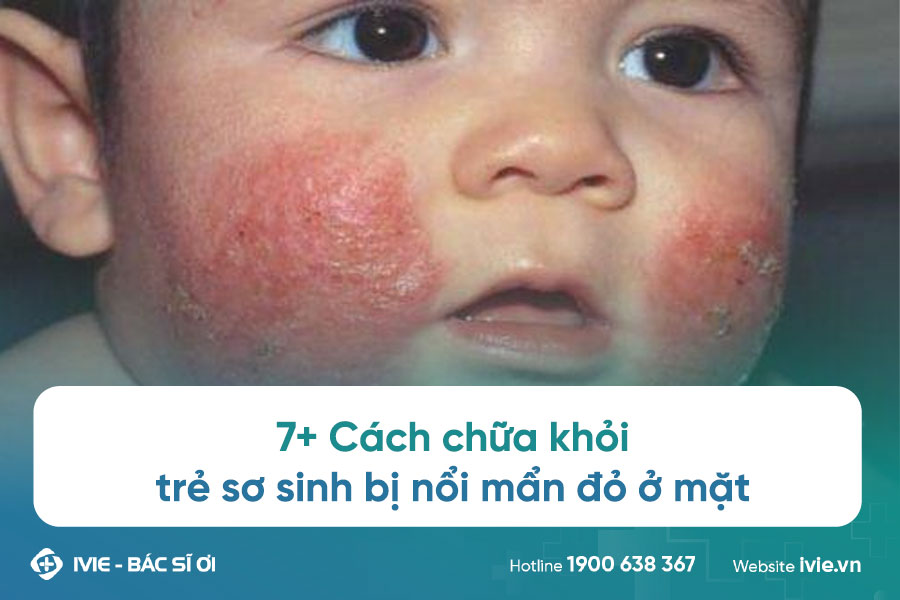 7+ Cách chữa khỏi trẻ sơ sinh bị nổi mẩn đỏ ở mặt