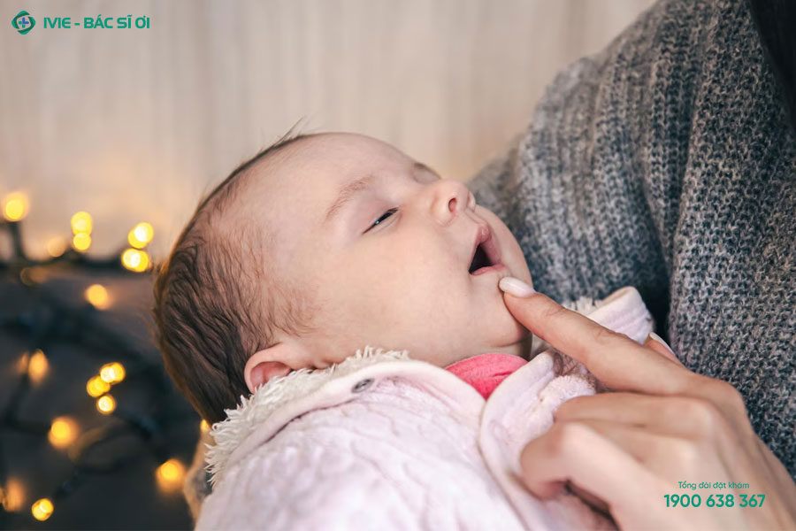 Trẻ sơ sinh sổ mũi thường do sự tăng tiết dịch nhầy của lớp niêm mạc hốc mũi