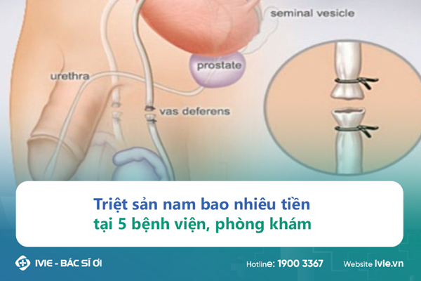 Triệt sản nam bao nhiêu tiền tại 5 bệnh viện, phòng khám