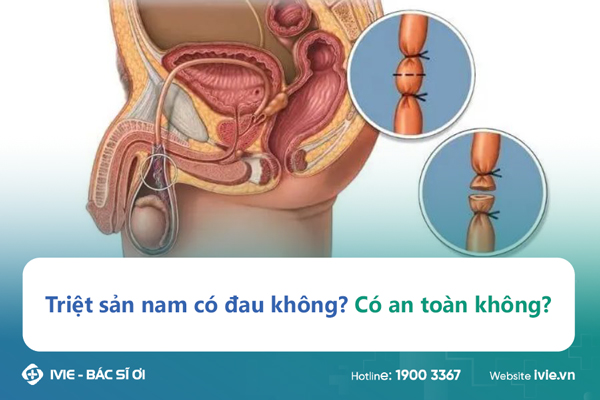 Triệt sản nam có đau không? Có an toàn không?