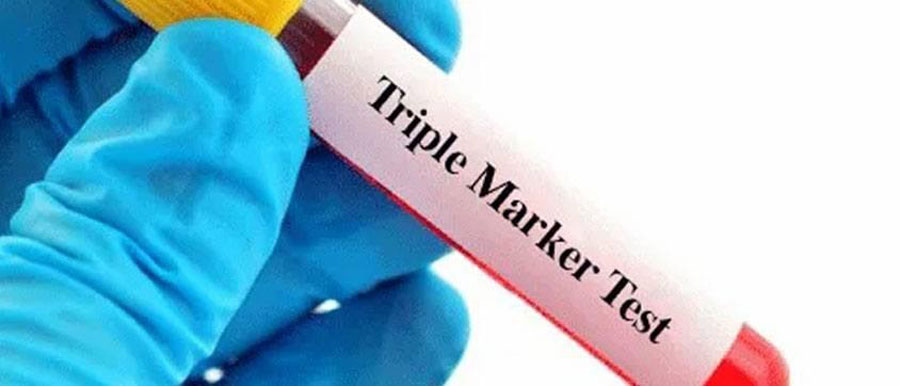  test sàng lọc dị tật thai nhi: Triple Test