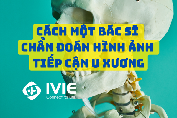 Các loại u xương mọt gặm phổ biến?
