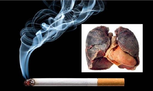 Viêm phổi tắc nghẽn mãn tính thường gặp ở độ tuổi trung niên, đặc biệt là đối tượng hút thuốc lá nhiều.