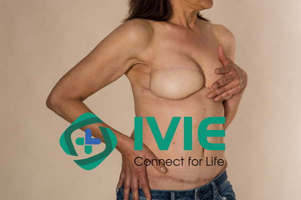 Ung thư vú và những dấu hiệu cảnh báo bạn không nên bỏ qua 