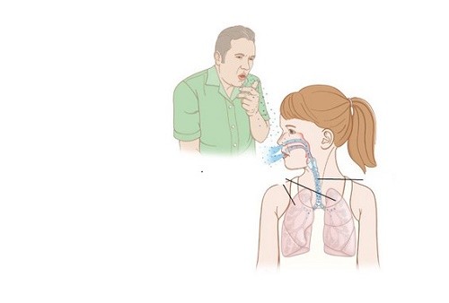 Khi vi khuẩn lao xâm nhập vào cơ thể lần đầu tiên gây ra các triệu chứng lâm sàng, tổn thương trên Xquang phổi và chuyển phản ứng Mantoux từ (-) sang (+) – đó là lao sơ nhiễm.