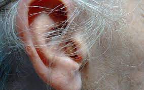 Hướng dẫn cách vệ sinh tai khi viêm tai ngoài ở trẻ em