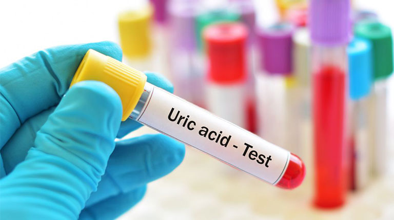 Xét nghiệm chỉ số Acid Uric