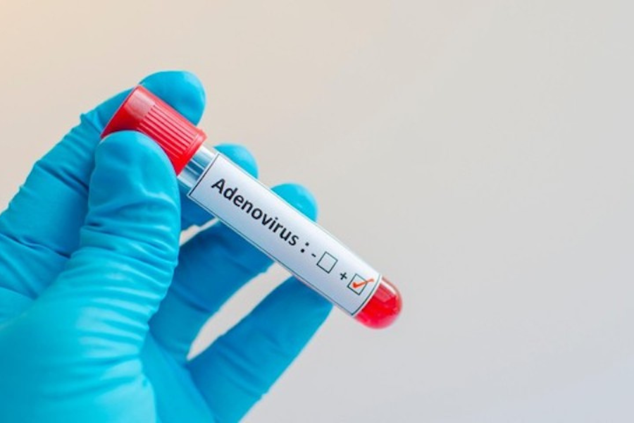Xét nghiệm Adenovirus là xét nghiệm chẩn đoán xác định tình trạng trẻ nhiễm Adenoviru