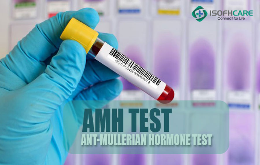  Hormon Anti-Mullerian (AMH) là gì?