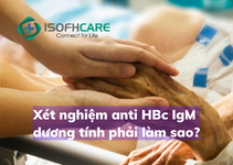Xét nghiệm anti HBc IgM dương tính phải làm sao?
