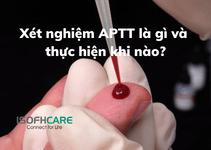 Xét nghiệm APTT là gì và thực hiện khi nào?