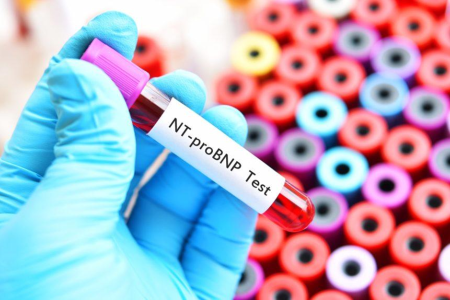 Xét nghiệm BNP và NT-proBNP hỗ trợ chẩn đoán và theo dõi điều trị người bệnh suy tim
