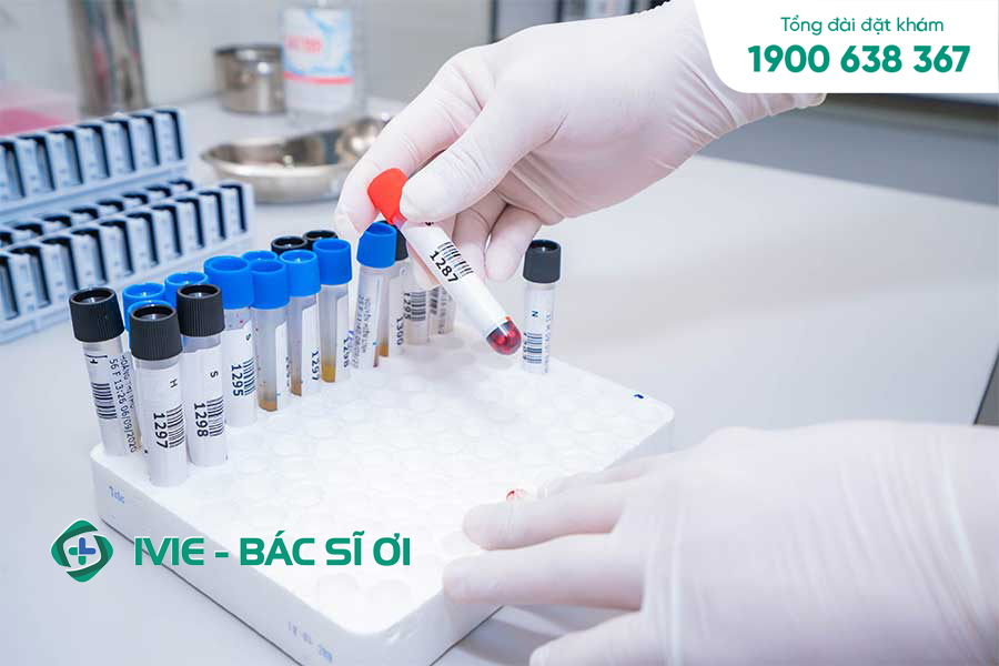 Xét nghiệm chức năng gan là một trong những xét nghiệm sinh hoá được chỉ định để có thể đánh giá được các chức năng khác nhau của gan