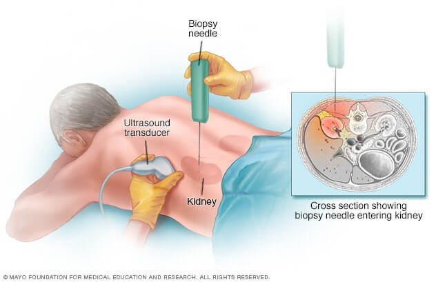 Một số xét nghiệm đánh giá chức năng thận bạn cần biết