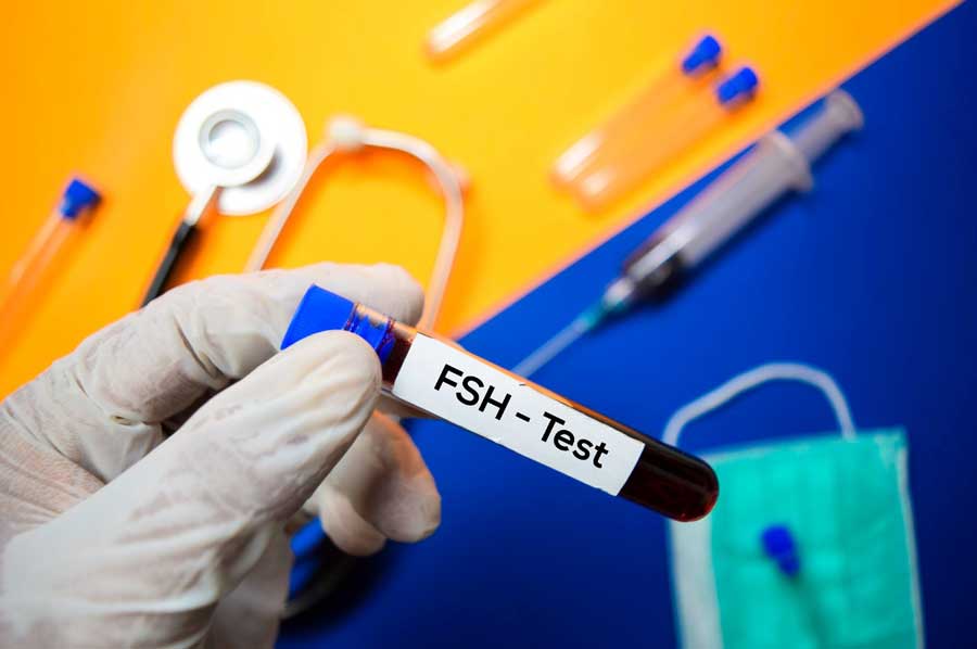 Định lượng nồng độ LH, FSH giúp chẩn đoán Suy sinh dục ở trẻ vị thành niên