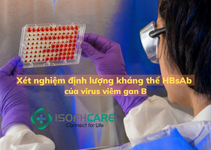 Xét nghiệm định lượng kháng thể HBsAb của virus viêm gan B