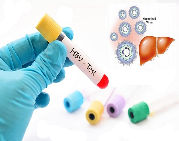 Xét nghiệm Định lượng Virus Viêm gan B (HBV-DNA)
