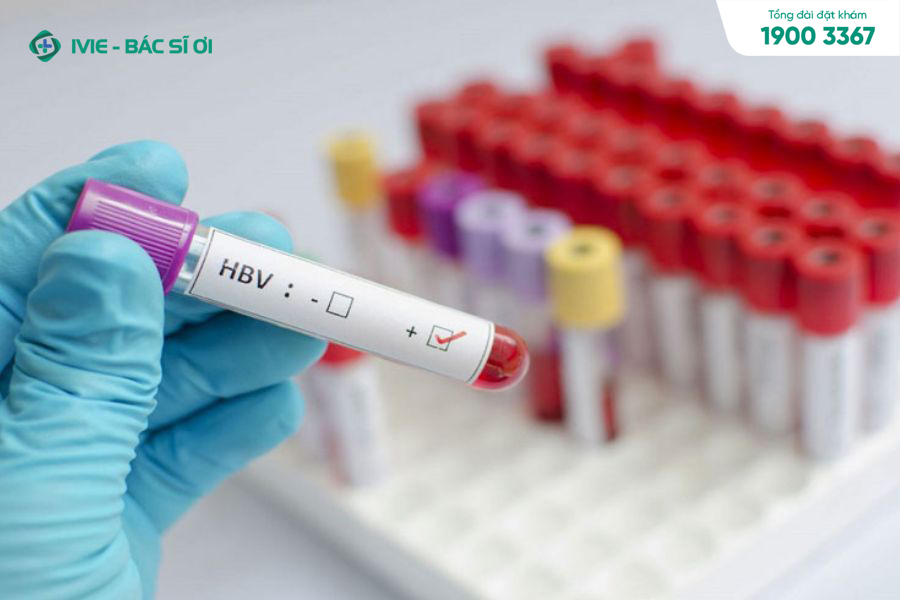 Xét nghiệm HBV được thực hiện để xét định virus viêm gan B có tồn tại trong máu hay không