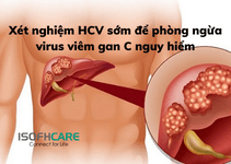 ​​​​​​​Xét nghiệm HCV sớm để phòng ngừa virus viêm gan C...