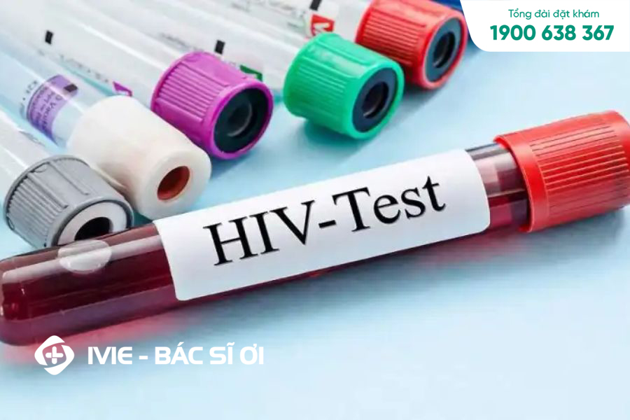 Xét nghiệm HIV từ 3 đến 6 tháng để đảm bảo kết quả chính xác nhất