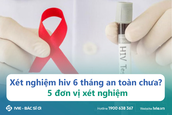 Xét nghiệm hiv 6 tháng an toàn chưa? 5 đơn vị xét nghiệm