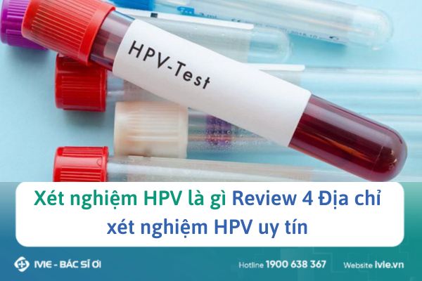 Xét nghiệm HPV là gì Review 4 Địa chỉ xét nghiệm HPV uy tín