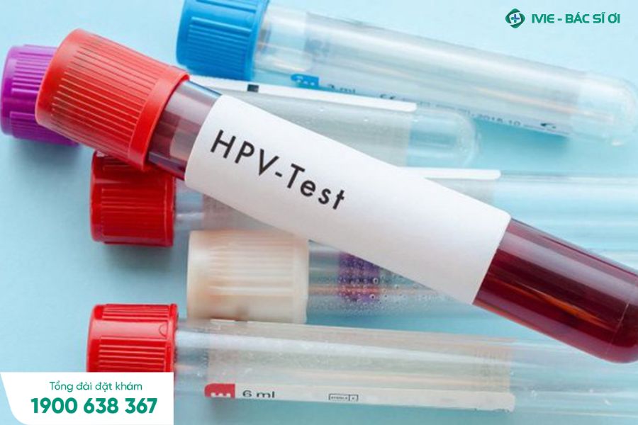 Xét nghiệm HPV nhằm đánh giá nguy cơ nhiễm HPV của bạn