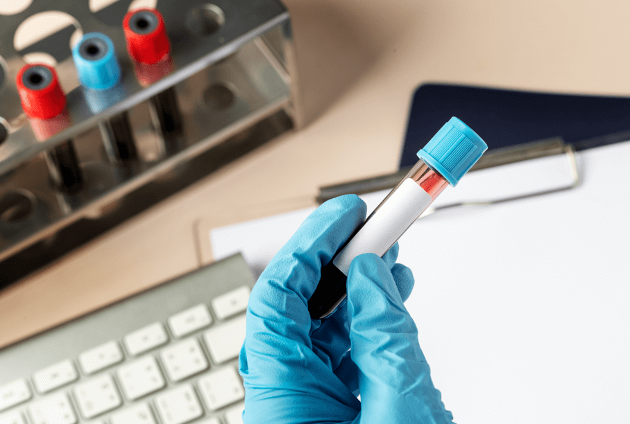 Tiêm vaccine sau bao lâu cần xét nghiệm kháng thể?