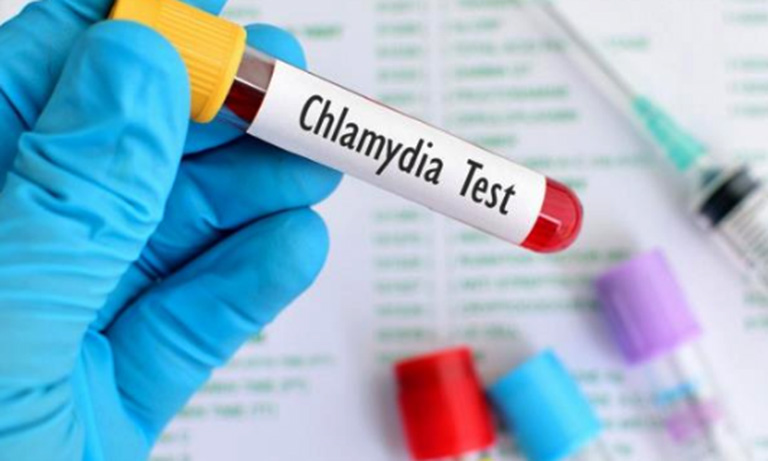 Xét nghiệm Chlamydia Lậu PCR - TTXN MEIDCEN