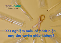 Nguyên nhân gây tăng và giảm chỉ số ung thư tuyến giáp trong xét nghiệm máu?
