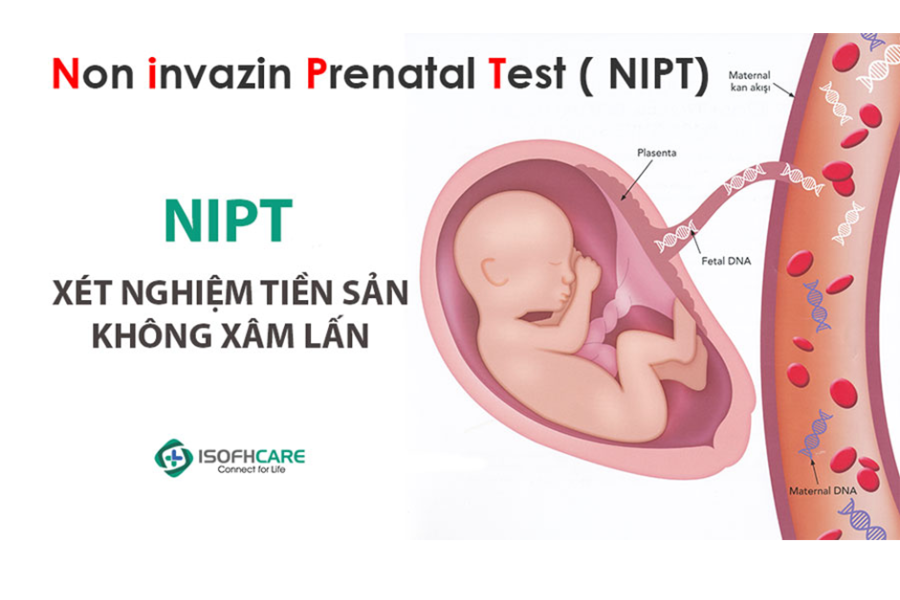 Xét nghiệm sàng lọc trước sinh (NIPT) là một kỹ thuật xác định nguy cơ dị tật, bệnh bẩm sinh ở thai nhi